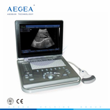 AG-BU009 Type d&#39;ordinateur portable pour la Chine de scanner d&#39;échographie humaine ou vétérinaire